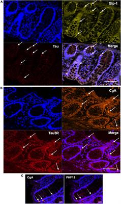 Tau expression and phosphorylation in enteroendocrine cells